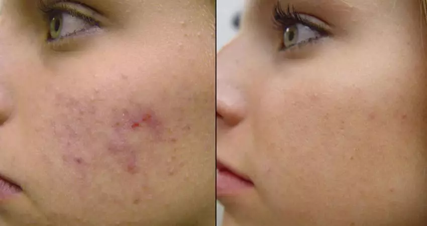 گالری تصاویر